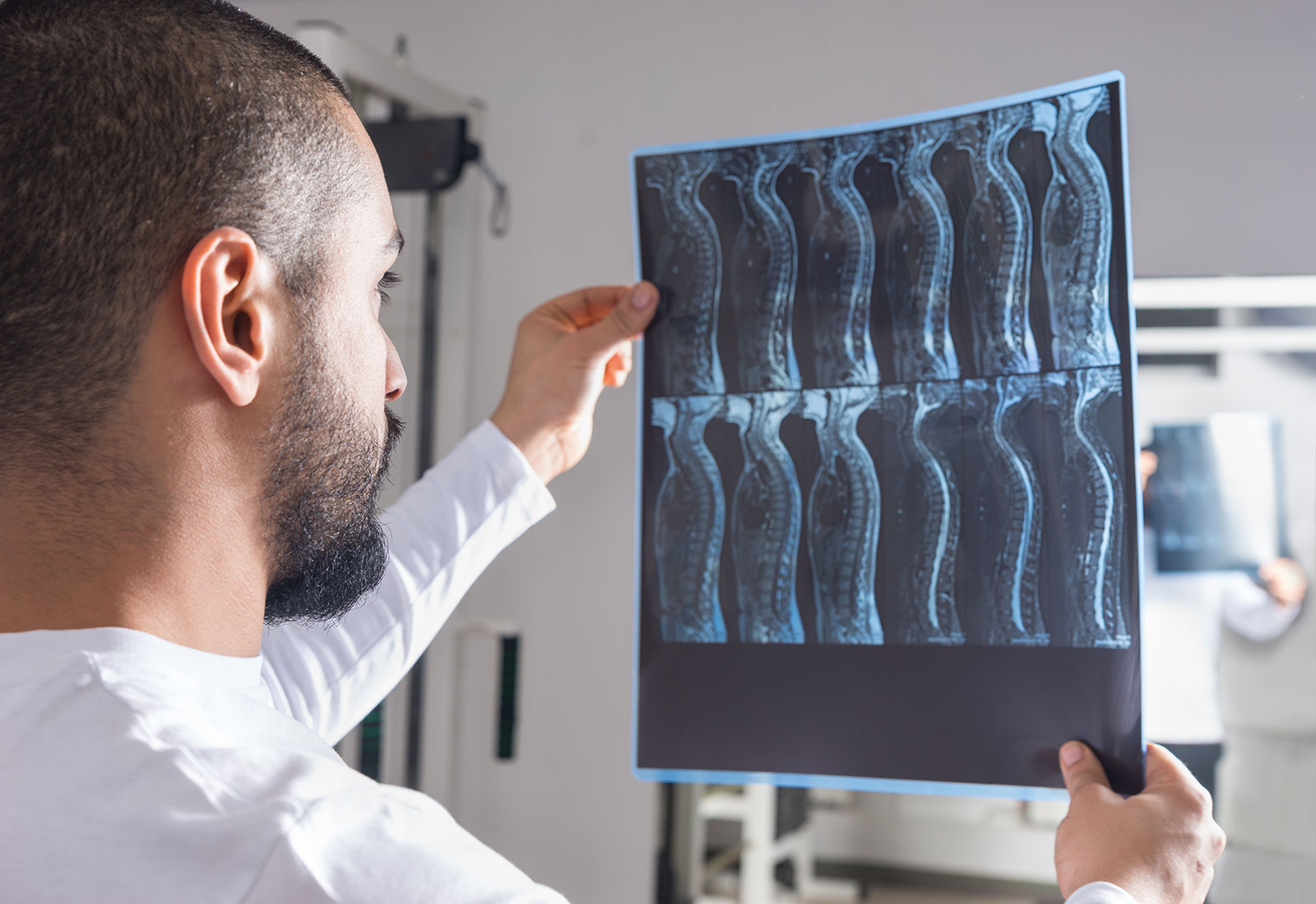 Doctor holding up and examine an X-ray with multiple views of spinal cord