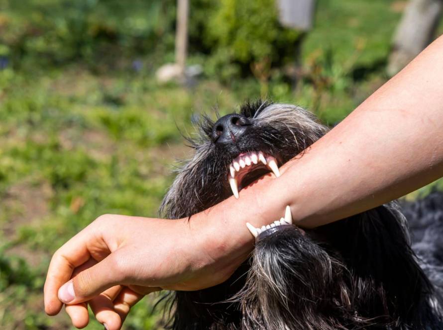 dog bite